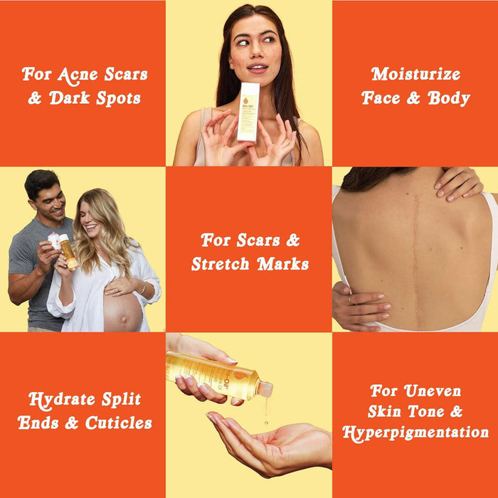 Bio-Oil Skincare Body Oil (Natural) Serum for Scars and Stretchmarks, Face and Body Moisturizer Hydrates Skin, with Organic Jojoba Oil and Vitamin E, For All Skin Types