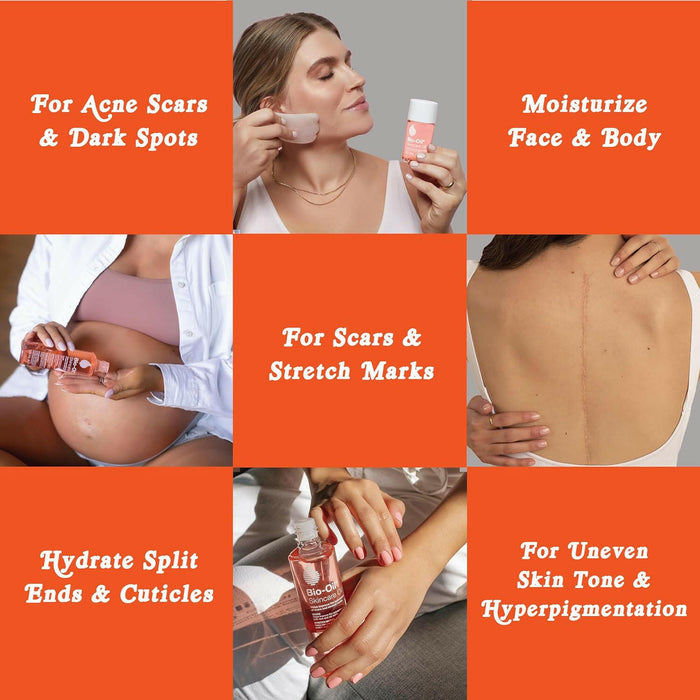 Bio-Oil Skincare Body Oil, Vitamin E, Serum for Scars & Stretchmarks, Face & Body Moisturizer