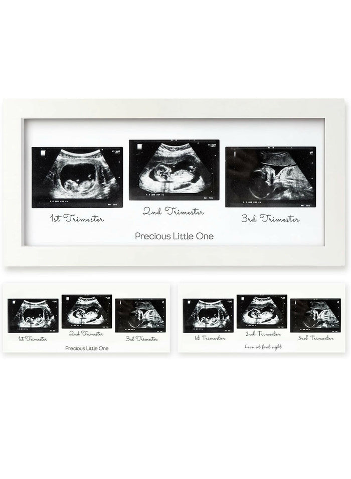 Baby Sonogram Picture Frame.