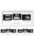 Baby Sonogram Picture Frame.