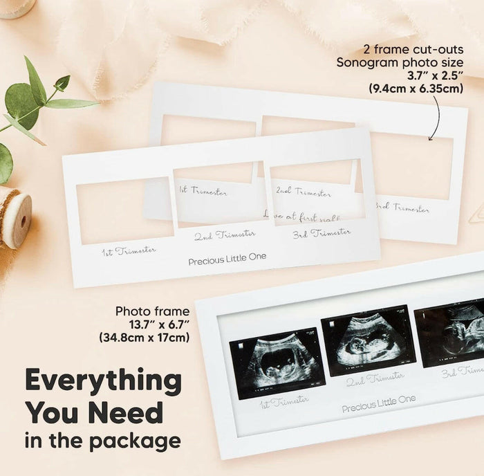 Baby Sonogram Picture Frame.