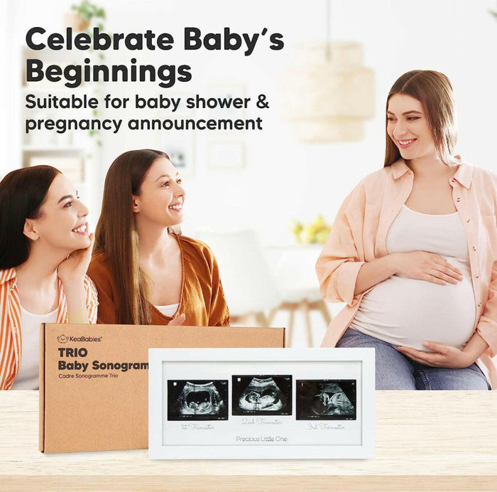 Baby Sonogram Picture Frame.