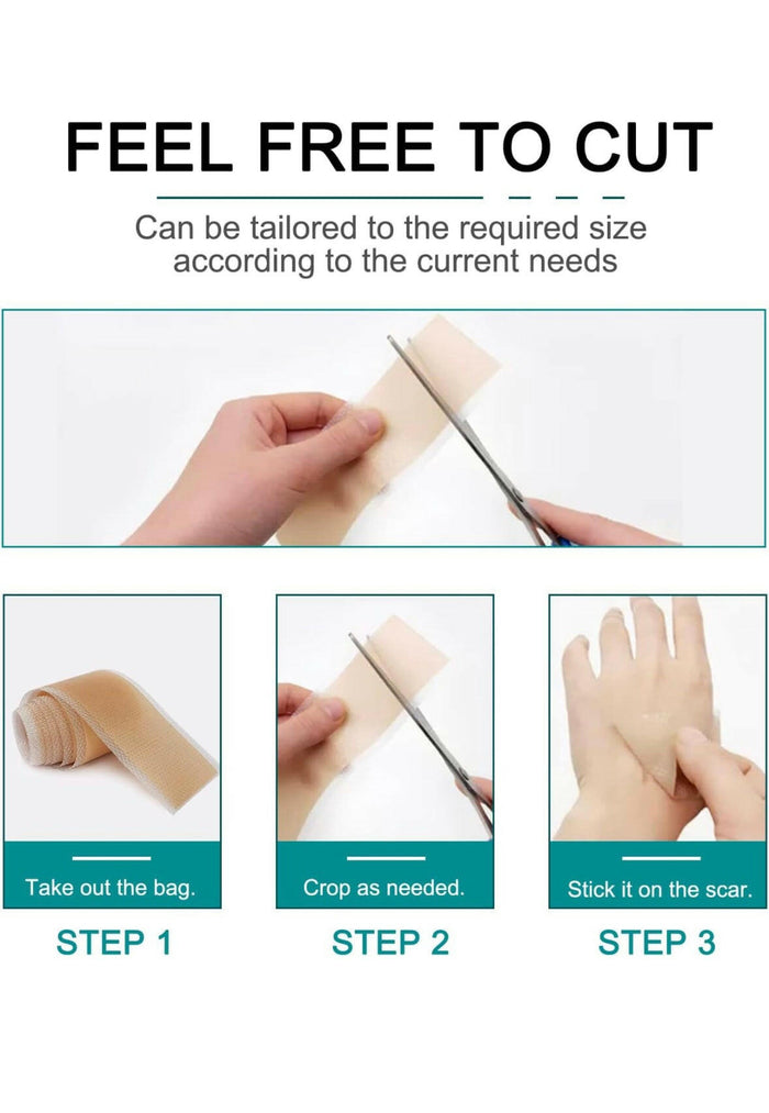 Silicone Scar Sheets (1.6” x 120” Roll-3M).